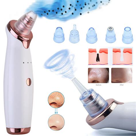 Electric Facial Blackhead Remover Nose Pore Pimple Cleaner Vacuum ...