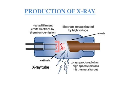 X ray ppt