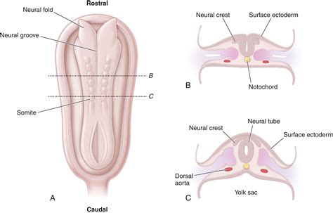 Disorders of the Spinal Cord - Clinical Tree