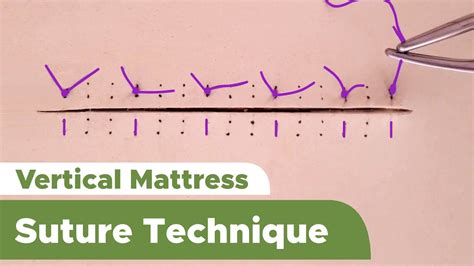 Suture Techniques and Training Series: Interrupted Vertical Mattress Suture Technique - YouTube