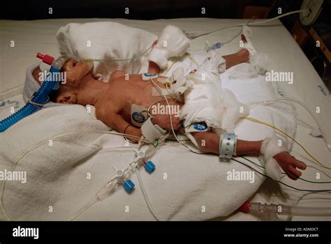 Premature baby at neonatal intensive care unit Stock Photo - Alamy