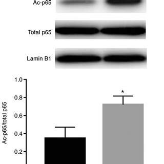 p65 acetylation is upregulated by TSA. Immunoblotting results of Ac-p65... | Download Scientific ...