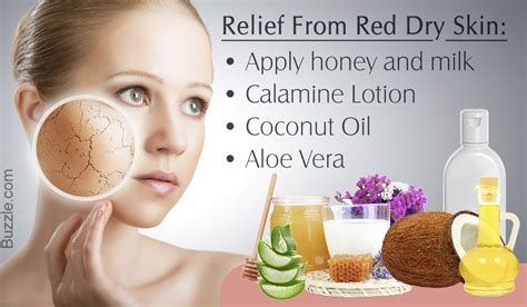 Remedies for red dry skin | Red dry skin, Dry skin diet, Dry skin routine