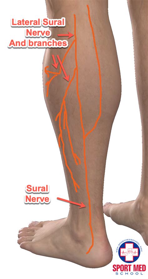 Sural Nerve Entrapment | Sport Med School