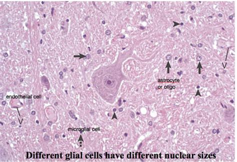 Oligodendrocyte Histology