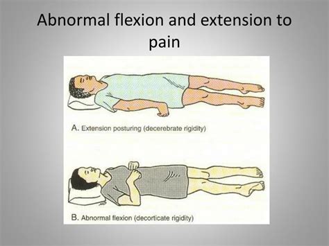 PPT - The Glasgow Coma Scale (GCS) PowerPoint Presentation, free download - ID:6673594