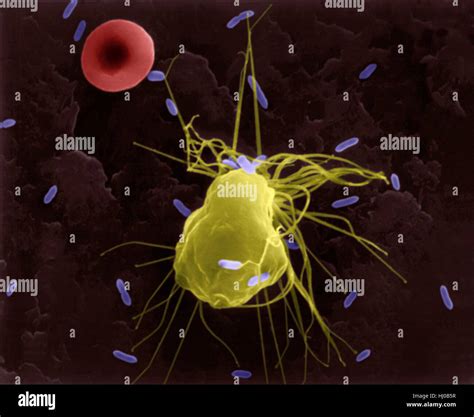 Alveolar macrophage phagocytosis of E. coli, coloured scanning Stock Photo: 131545171 - Alamy