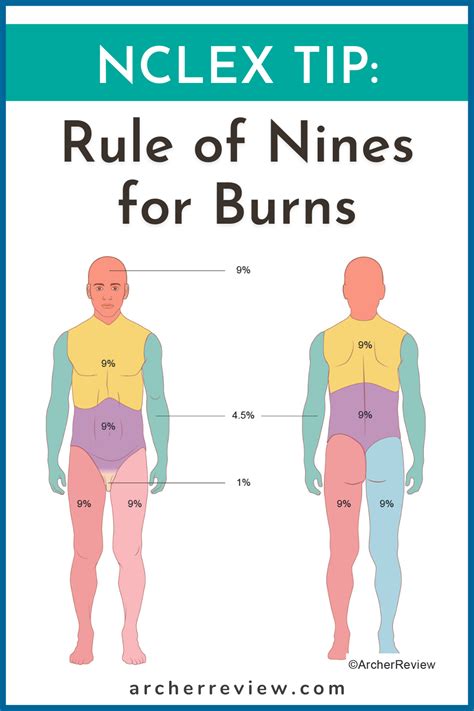 NCLEX Tip: Rule of Nines for Burns | Nclex, Rule of nines, Nursing school tips