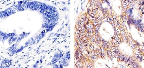 EpCAM Antibody (MA5-12442)