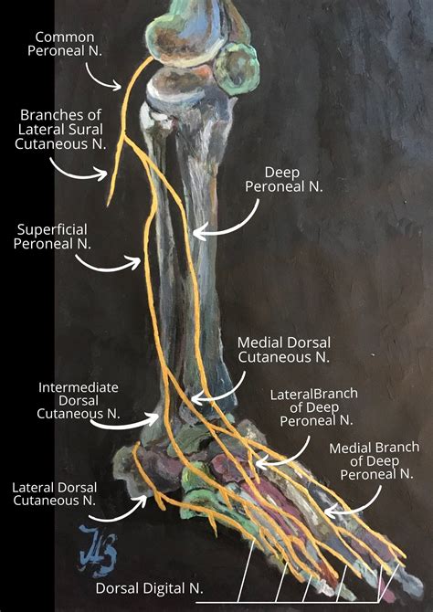 Sciatica, Lower Back Pain & the Sciatic Nerve