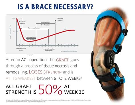 Best 25+ Acl brace ideas on Pinterest | Acl knee brace, Acl knee and ...