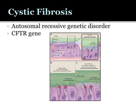 Gene Therapy For Cystic Fibrosis