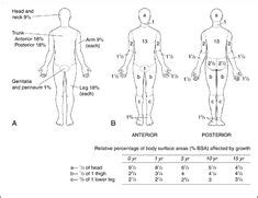 Total Body Surface Area illustration of the Rule of Nine, adult and ...