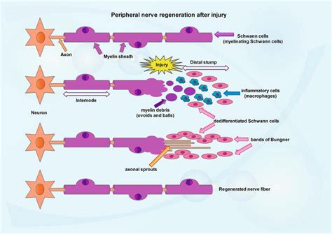 Schwann Cell Plasticity in Peripheral Nerve Regeneration after Injury | IntechOpen