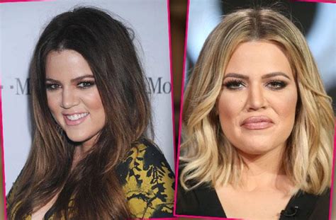 Nothing To Smile About! Khloe Kardashian 'Miserable' Over Plumped Lips