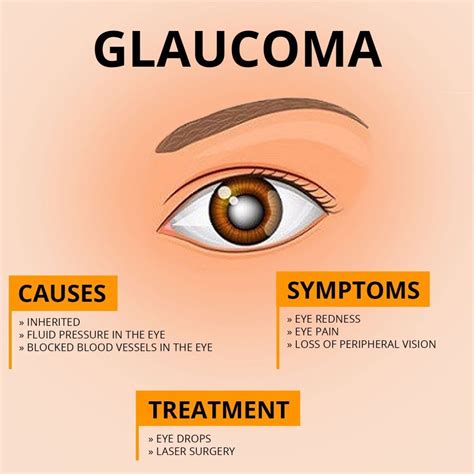 Best Glaucoma Treatment in Dubai | Eye Consultants