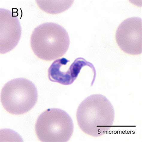 Trypanosoma cruzi morphological forms. (A) The replicating epimastigote ...