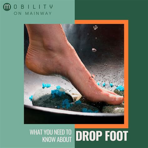 Drop Foot - Causes, Symptoms, Treatments | Mobility on Mainway