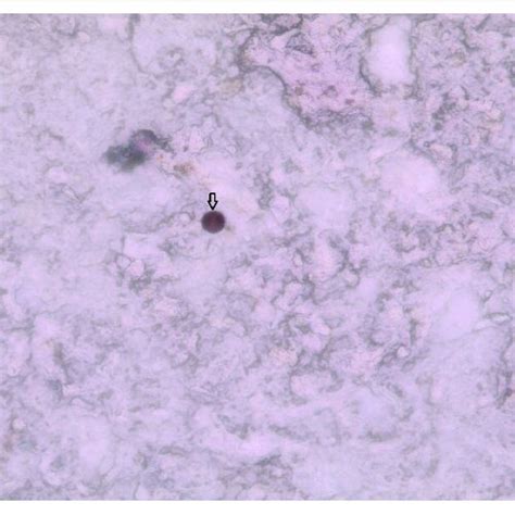The image of Cryptosporidium spp. oocyst in stool sample from kinyoun... | Download Scientific ...