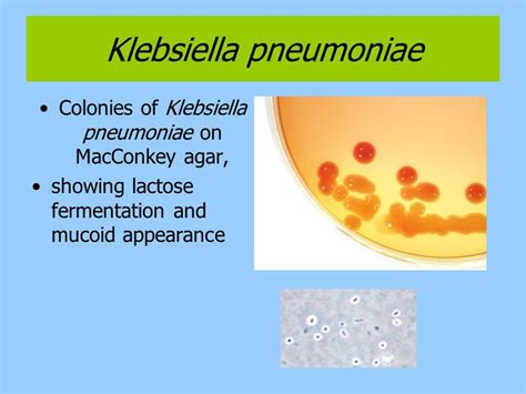 Antibiotic treatment for klebsiella pneumoniae uti