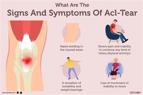 Anterior Cruciate Ligament (ACL) Tear: Symptoms, Causes, Treatment, and Cost