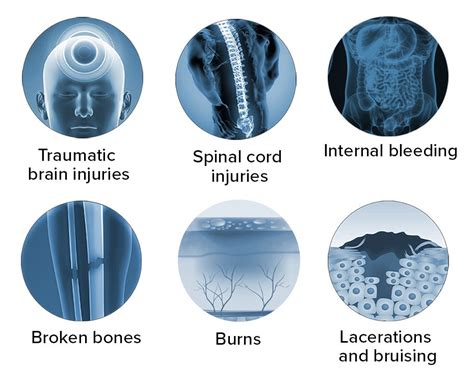 Bicycle Accident Injuries - The Advocates