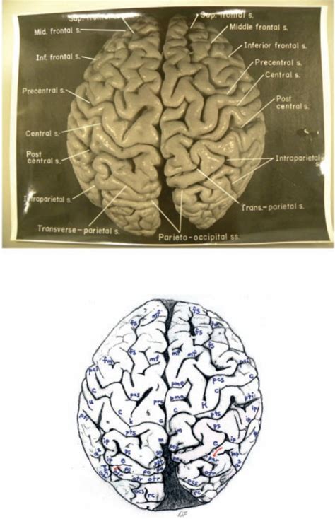 Albert Einstein Brain X-Ray | Two Views