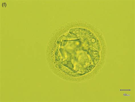 Chapter 11 – Oocyte Retrieval and Embryo Culture | Obgyn Key