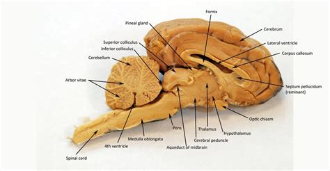 Fornix Sheep Brain The fornix is a bundle of fibers that parallels the ...