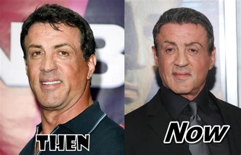 Sylvester Stallone Plastic Surgery Before and After Pictures Expendables | 2018 Plastic Surgery ...