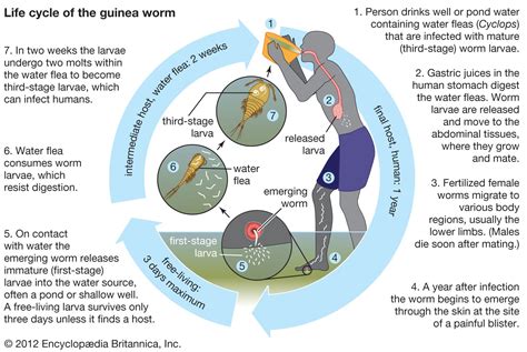 Guinea worm disease | Definition, Infection, Treatment, & Eradication | Britannica