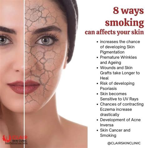 8 ways smoking can effects your skin in 2024 | Skin clinic, Smoking ...