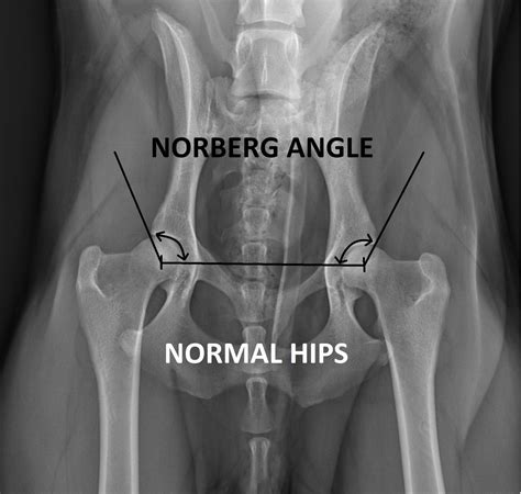 Normal hip vs hip dysplasia xray - polfpot