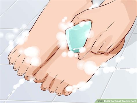 How to Treat Trench Foot: 11 Steps (with Pictures) - wikiHow