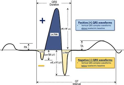 QRS complex waveform measurements. Schematic representation of a... | Download Scientific Diagram