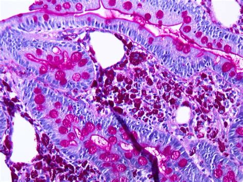 What is the Difference Between H&E and PAS Stain | Compare the Difference Between Similar Terms