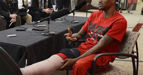 Kevin Ware, injured Louisville guard, remains upbeat despite broken leg - CBS News