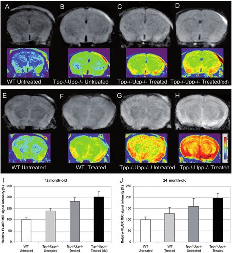 FLAIR MRI signal in the cerebral hemispheres of 12-month-old (A-D) and... | Download Scientific ...