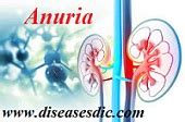 Anuria – Definition, Causes, Symptoms, Treatment.