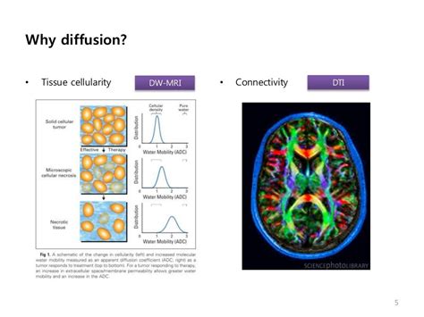 Diffusion Weighted MRI (2011-09-29 이정원)