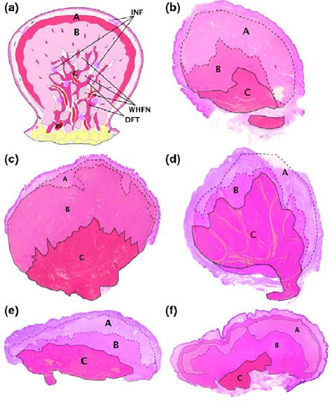 Examples of collagen microarchitecture of the cases with positive and ...