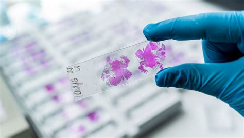 BioAssays in vivo - Texcell