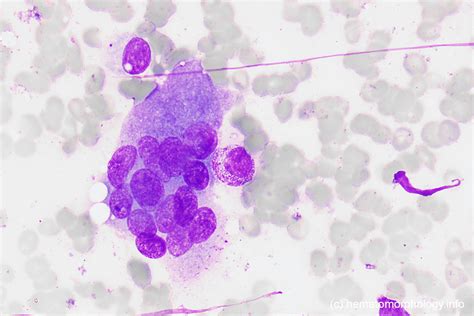 Osteoclast Histology