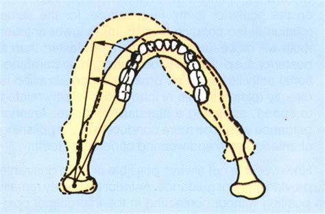 16 – Restoration of Anterior Teeth | Pocket Dentistry