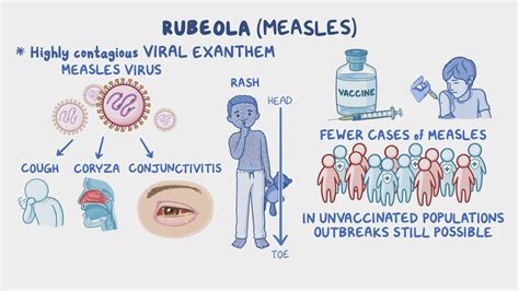 Rubella Vs Rubeola Rash