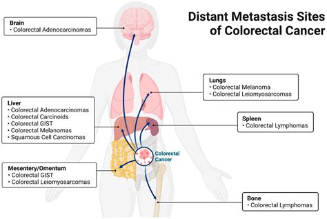 Cancers | Free Full-Text | Bacterial Involvement in Progression and ...