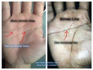 Simian Line Personality Survey - Destiny Palmistry