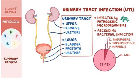 Video: Urinary tract infections (UTIs): Nursing process (ADPIE)