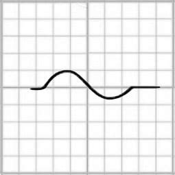 P wave • LITFL • ECG Library Basics