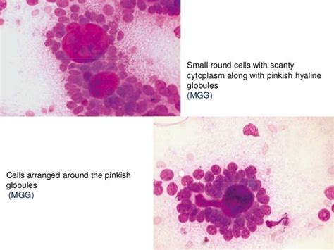 FINE NEEDLE ASPIRATION CYTOLOGY / FNAC